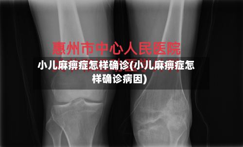 小儿麻痹症怎样确诊(小儿麻痹症怎样确诊病因)