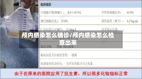 颅内感染怎么确诊/颅内感染怎么检查出来
