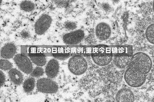【重庆20日确诊病例,重庆今日确诊】-第2张图片