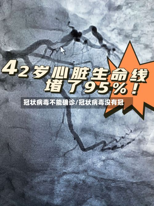 冠状病毒不能确诊/冠状病毒没有冠
