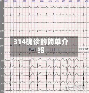 314确诊的简单介绍-第3张图片