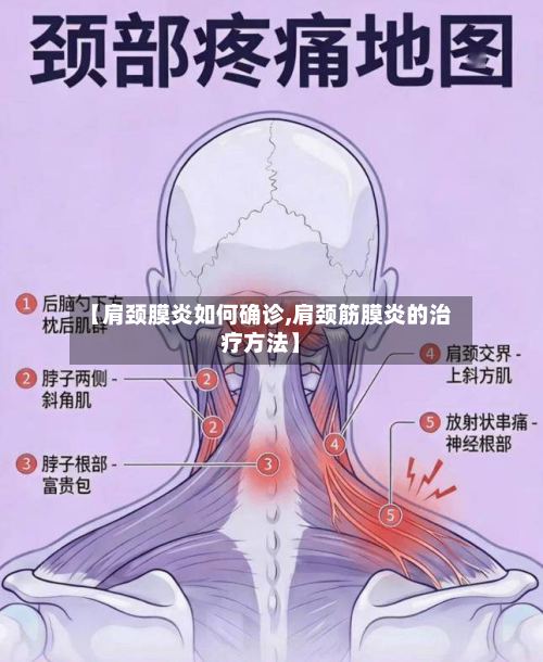 【肩颈膜炎如何确诊,肩颈筋膜炎的治疗方法】-第3张图片