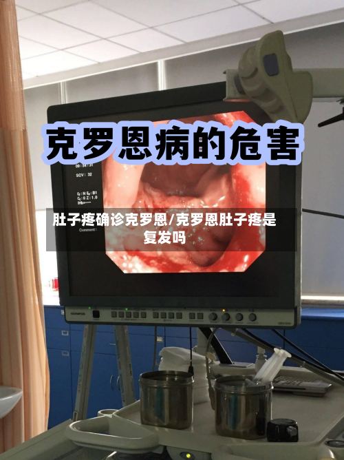 肚子疼确诊克罗恩/克罗恩肚子疼是复发吗-第2张图片