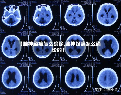 【脑神经痛怎么确诊,脑神经痛怎么确诊的】-第3张图片