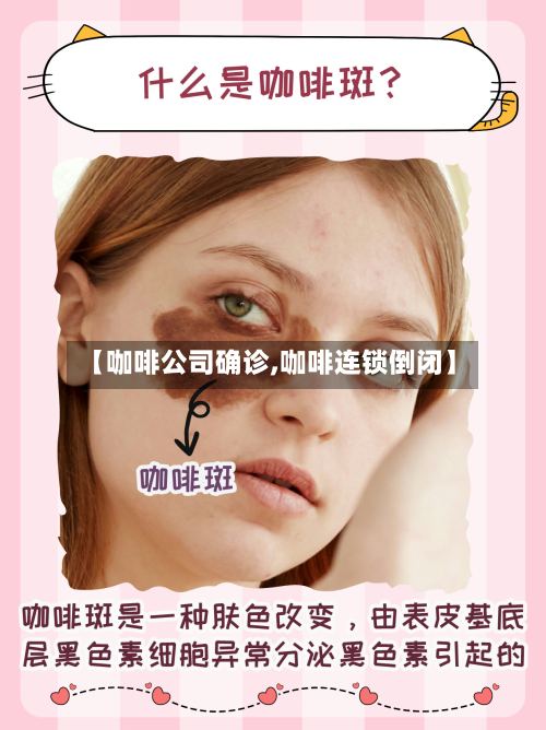 【咖啡公司确诊,咖啡连锁倒闭】-第3张图片