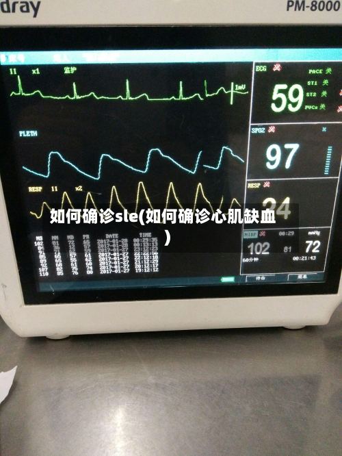 如何确诊sle(如何确诊心肌缺血)