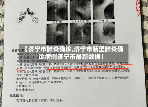 【济宁市肺炎确诊,济宁市新型肺炎确诊病例济宁市最新数据】-第3张图片