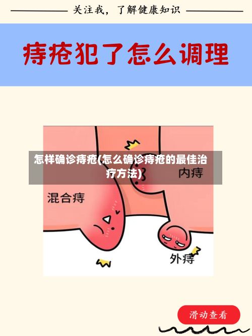 怎样确诊痔疮(怎么确诊痔疮的最佳治疗方法)