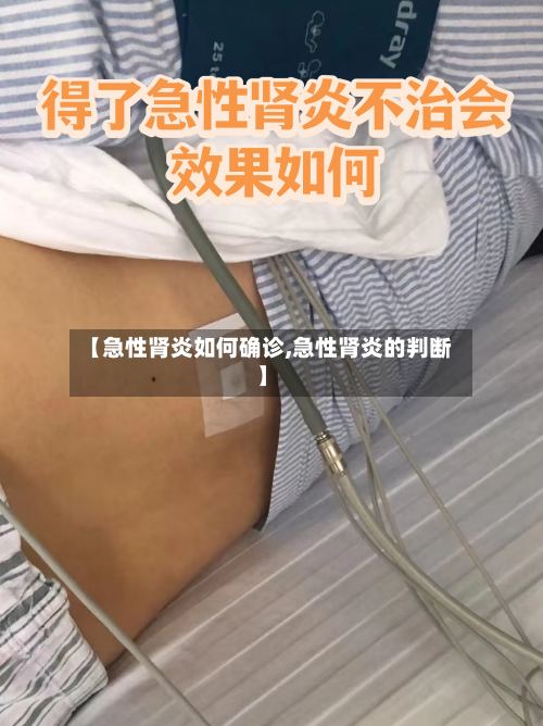 【急性肾炎如何确诊,急性肾炎的判断】