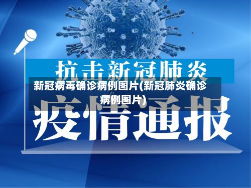 新冠病毒确诊病例图片(新冠肺炎确诊病例图片)-第2张图片