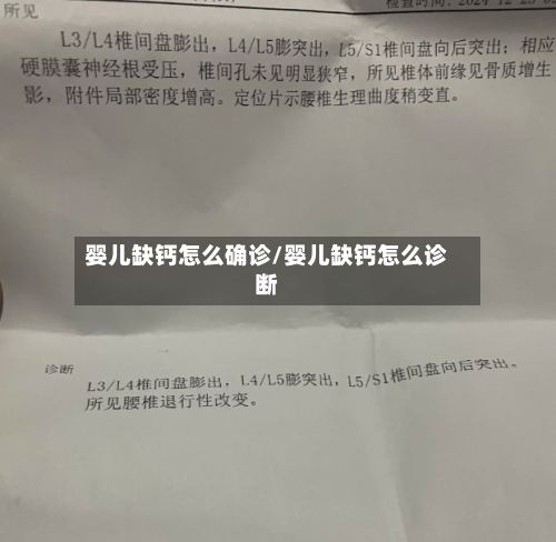 婴儿缺钙怎么确诊/婴儿缺钙怎么诊断-第2张图片