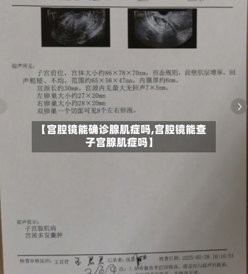 【宫腔镜能确诊腺肌症吗,宫腔镜能查子宫腺肌症吗】-第2张图片