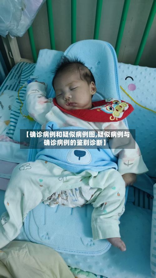 【确诊病例和疑似病例图,疑似病例与确诊病例的鉴别诊断】-第2张图片