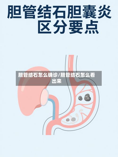 胆管结石怎么确诊/胆管结石怎么看出来