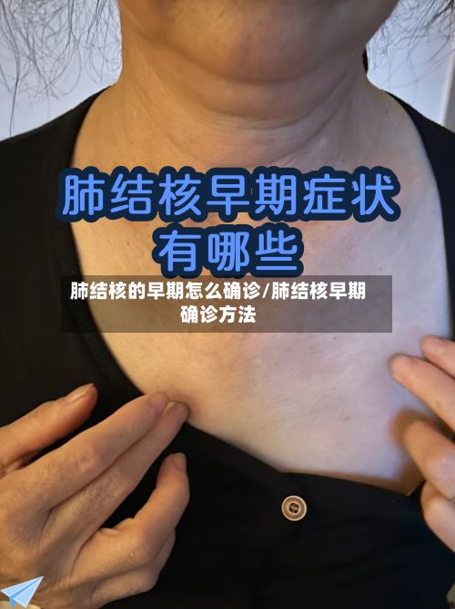 肺结核的早期怎么确诊/肺结核早期确诊方法