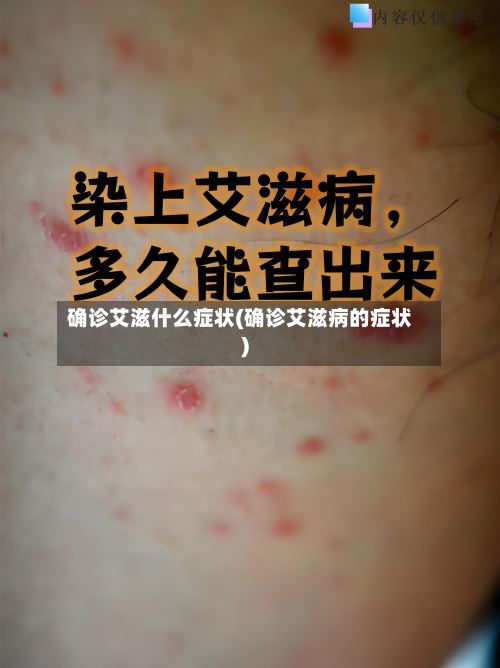 确诊艾滋什么症状(确诊艾滋病的症状)-第2张图片