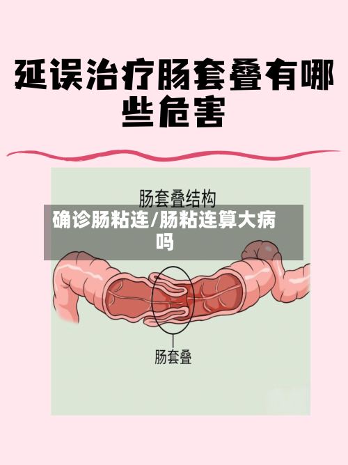 确诊肠粘连/肠粘连算大病吗-第2张图片