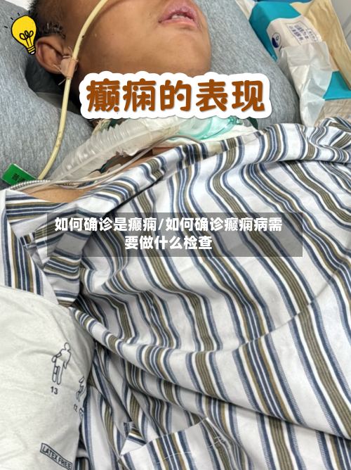 如何确诊是癫痫/如何确诊癫痫病需要做什么检查-第2张图片